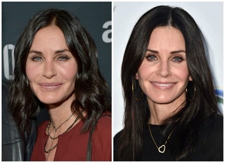 A picture of Courteney Cox before (left) and after (right) removing the fillers from her face.